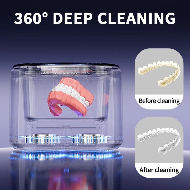 50kHz Ultrasonic Retainer & Jewelry Cleaner – USB Rechargeable